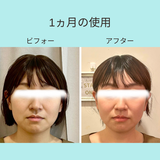 ヘッドスパリフトSET