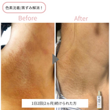 リッドリッチオイル(フェイス&ボディ)100㎖