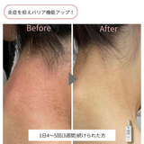 リッドリッチオイル(フェイス&ボディ)100㎖