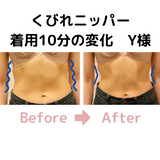 くびれニッパー