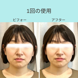 ヘッドスパリフトSET