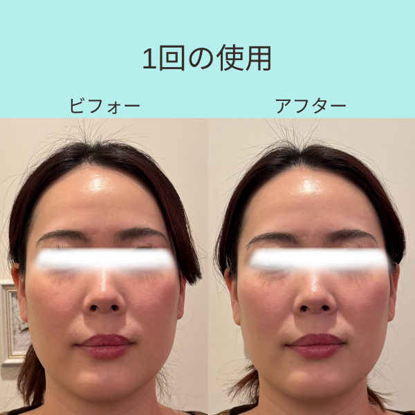 ヘッドスパリフトSET