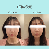 ヘッドスパリフトSET