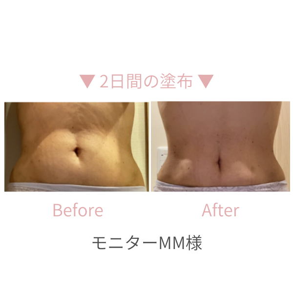 Chabi 育乳ブラ　クビレジェル